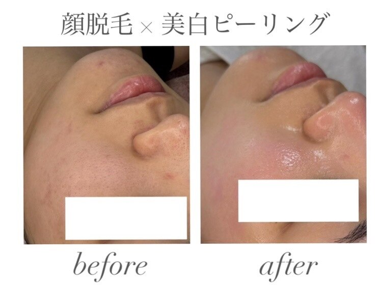 施術前後のイメージ：姿勢ケア・血流ケアで体の軽さを感じていただくシーン