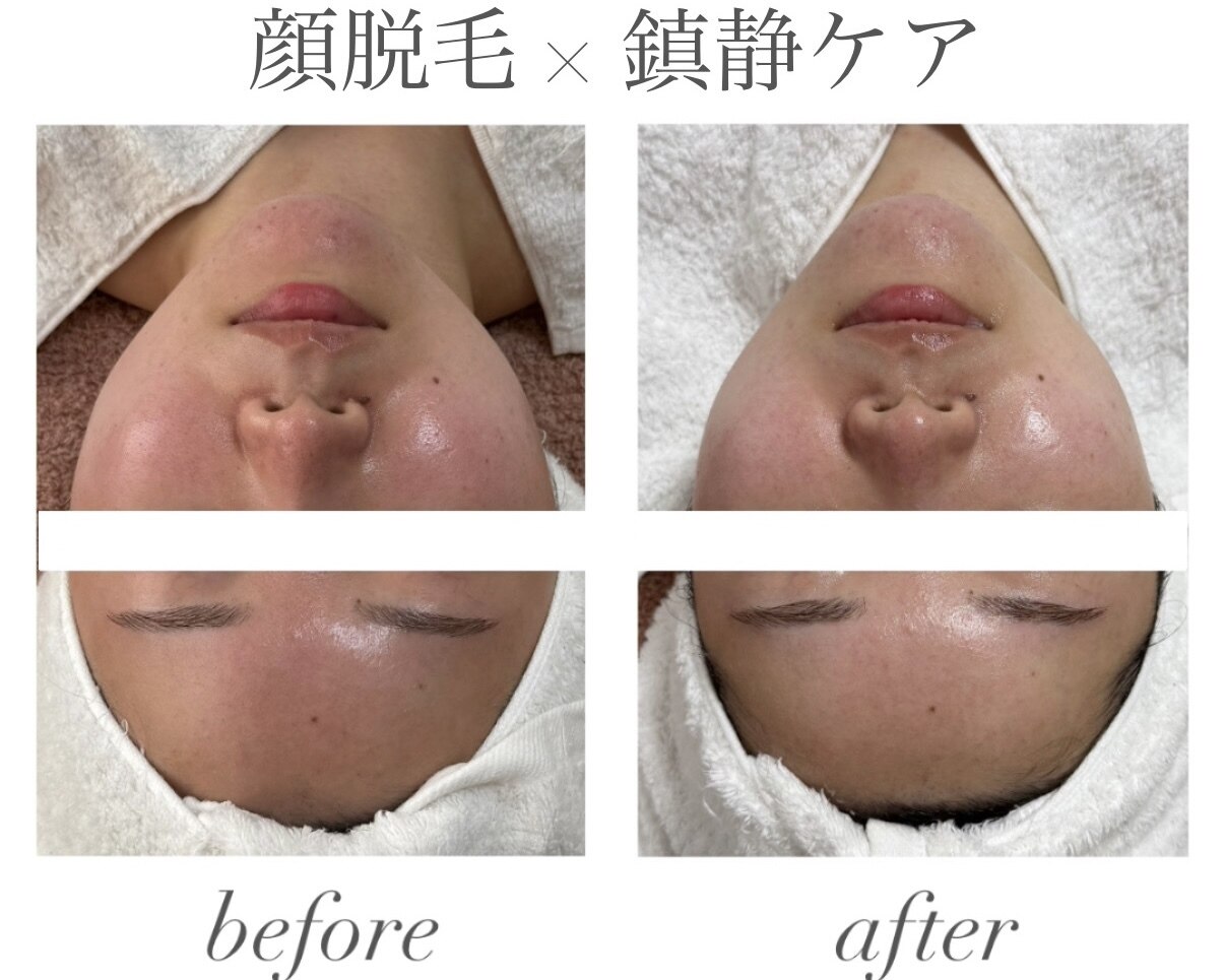 サロンのこだわり②マッサージオイル：純度100%精油＋キャリアオイル